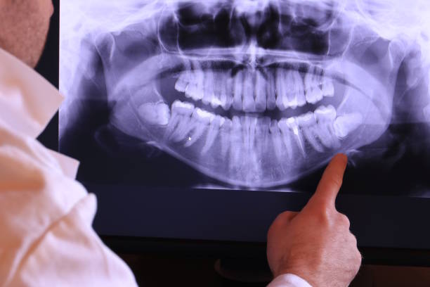 Best Broken or Chipped Tooth Repair in Dundee, FL