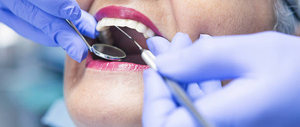 Best Walk-In Emergency Dental Services in Dundee, FL